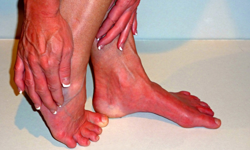 A woman with red feet and hands.